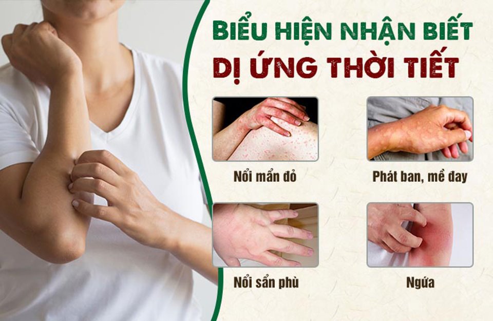 Dị ứng thời tiết - Nỗi ám ảnh ngày giao mùa