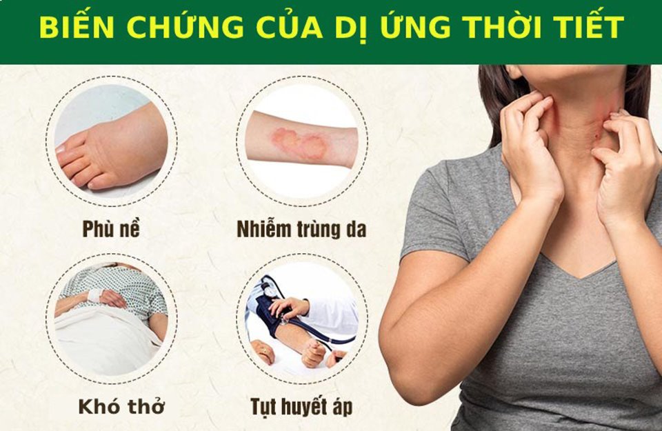 Dị ứng thời tiết - Nỗi ám ảnh ngày giao mùa