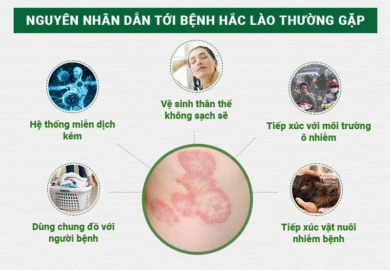 Thuốc chữa hắc lào: những điều nên biết trước khi sử dụng